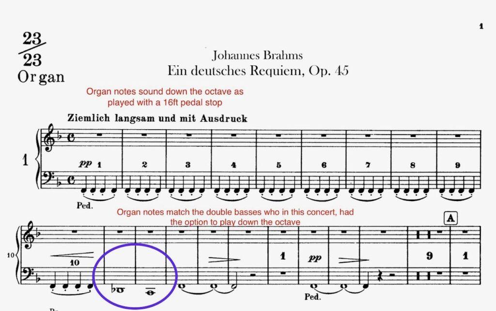 Organ part